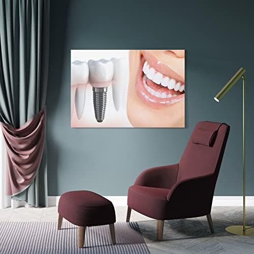 Изкуството на Зъбни импланти， Стоматологични услуги, Дентална клиника, Зъболекарски кабинет, с монтиран на стената Art Декоративни